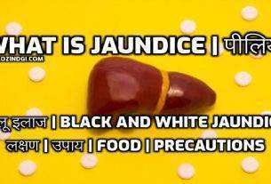 What is Jaundice पीलिया घरेलू इलाज Black and White jaundice लक्षण उपाय Food Precautions